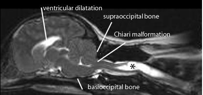 Chiari Shown in Human & Dog MRI